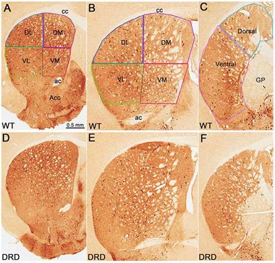 Striatal Cholinergic Interneurons in a Knock-in Mouse Model of L-DOPA-Responsive Dystonia